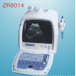 B mode Ultrasound scanner