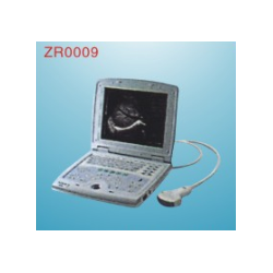 Digital Ultrasound system